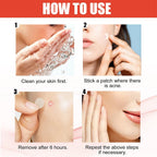 Invisible Pimple Patch Set - PURE VIBE LIMTED